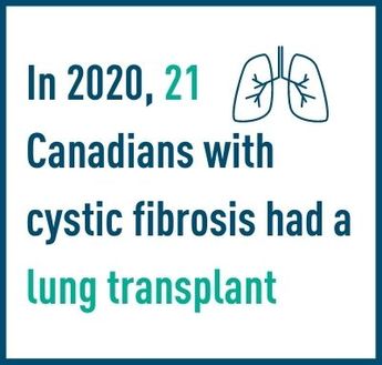 In 2020, 21 Canadians with cystic fibrosis had surgery for a lung transplant